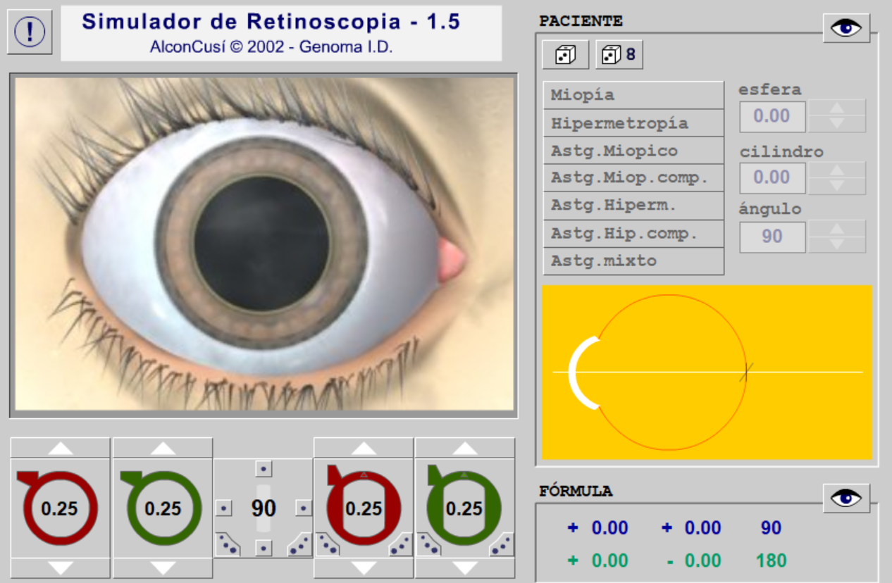Simulador de Retinoscopia Hospital Arruzafa